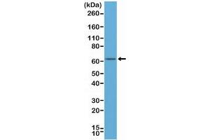Western blot of human MCF-7 cell lysates using recombinant Estrogen Receptor alpha antibody at a 1:500 dilution.