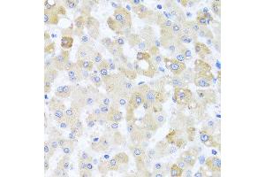 Immunohistochemistry of paraffin-embedded human liver injury using CETN1 antibody at dilution of 1:100 (x40 lens). (Centrin 1 Antikörper)