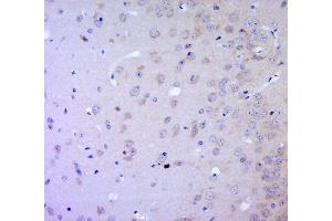 Immunohistochemistry (Paraffin-embedded Sections) (IHC (p)) image for anti-CD34 (CD34) (AA 201-300) antibody (ABIN676898)