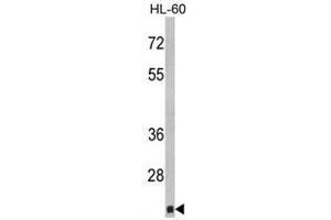 Image no. 1 for anti-Core-Binding Factor, beta Subunit (CBFB) (Middle Region) antibody (ABIN452819) (CBFB Antikörper  (Middle Region))