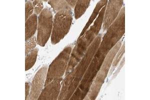 Immunohistochemical staining of human skeletal muscle with FAM198B polyclonal antibody  shows strong cytoplasmic positivity in myocytes. (FAM198B Antikörper)