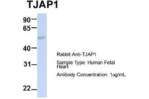 Host:  Rabbit  Target Name:  TJAP1  Sample Type:  Human Fetal Heart  Antibody Dilution:  1. (TJAP1 Antikörper  (N-Term))