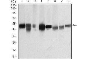 Western Blotting (WB) image for anti-Tubulin, beta 1 (TUBB1) (AA 33-166) antibody (ABIN5879491) (TUBB1 Antikörper  (AA 33-166))