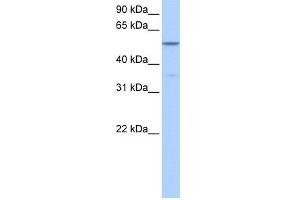 WB Suggested Anti-CHKA Antibody Titration: 0. (Choline Kinase alpha Antikörper  (Middle Region))