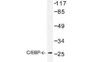 Image no. 1 for anti-CCAAT/enhancer Binding Protein (C/EBP), epsilon (CEBPE) antibody (ABIN272237) (CEBPE Antikörper)