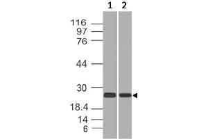 Image no. 1 for anti-RAP2A, Member of RAS Oncogene Family (RAP2A) antibody (ABIN5027782) (RAP2A Antikörper)