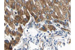 ABIN6266833 at 1/100 staining human liver tissue sections by IHC-P.