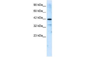 WB Suggested Anti-ZNF323 Antibody Titration:  2.