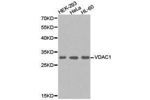 Western Blotting (WB) image for anti-Voltage-Dependent Anion Channel 1 (VDAC1) antibody (ABIN1875318)