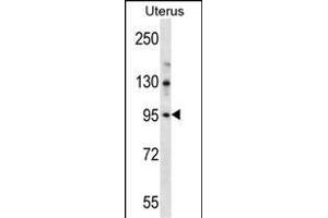LRRC37B Antibody (C-term) (ABIN657113 and ABIN2846260) western blot analysis in human normal Uterus tissue lysates (35 μg/lane). (LRRC37B Antikörper  (C-Term))