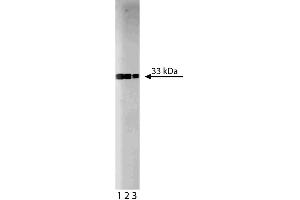 Western blot analysis of Cdk2 on a Jurkat lysate.