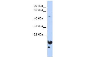 NUSAP1 antibody used at 1 ug/ml to detect target protein. (NUSAP1 Antikörper  (Middle Region))
