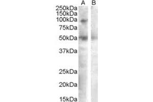 Western Blotting (WB) image for anti-Sulfatase 2 (SULF2) (AA 545-560) antibody (ABIN490407) (SULF2 Antikörper  (AA 545-560))
