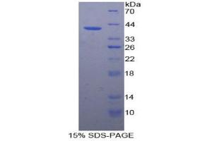 SDS-PAGE analysis of Rabbit VCAM1 Protein.