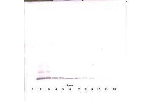 Image no. 4 for anti-Chemokine (C-C Motif) Ligand 8 (CCL8) antibody (ABIN465585) (CCL8 Antikörper)