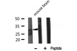 Western Blotting (WB) image for anti-Potassium Large Conductance Calcium-Activated Channel, Subfamily M, beta Member 2 (KCNMB2) (Internal Region) antibody (ABIN6257763)