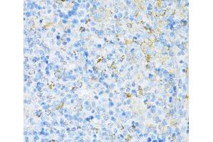 Immunohistochemistry (Paraffin-embedded Sections) (IHC (p)) image for anti-Vesicle-Associated Membrane Protein 1 (Synaptobrevin 1) (VAMP1) antibody (ABIN7264714)