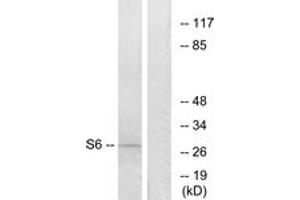 Western blot analysis of extracts from 293 cells, treated with serum 10% 15', using S6 Ribosomal Protein (Ab-235) Antibody. (RPS6 Antikörper  (AA 196-245))