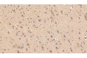 Immunohistochemistry (IHC) image for anti-Insulin-Like Growth Factor 1 (IGF1) (AA 49-118) antibody (ABIN7442501)