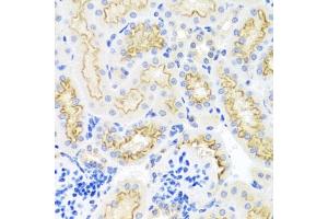 Immunohistochemistry of paraffin-embedded mouse kidney using SRPX antibody  at dilution of 1:100 (40x lens). (SRPX Antikörper  (AA 40-320))