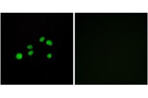 Immunofluorescence analysis of HepG2 cells, using Collagen XXIII alpha1 Antibody.