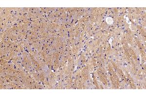 Immunohistochemistry (IHC) image for anti-Myelin Oligodendrocyte Glycoprotein (MOG) (AA 30-149) antibody (ABIN7429418)