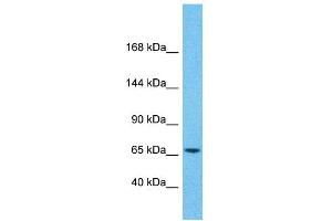 Host:  Rabbit  Target Name:  ZNF681  Sample Type:  Pancreas Tumor lysates  Antibody Dilution:  1. (ZNF681 Antikörper  (Middle Region))