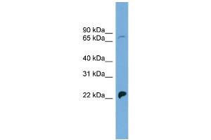 WB Suggested Anti-SLC5A5 Antibody Titration: 0. (SLC5A5 Antikörper  (N-Term))
