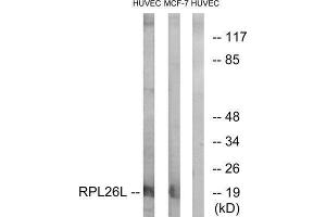 Western Blotting (WB) image for anti-RPL26L (RPL26L) (C-Term) antibody (ABIN1850620)