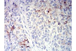 Immunohistochemistry (IHC) image for anti-Membrane Metallo-Endopeptidase (MME) (AA 549-750) antibody (ABIN5611261)