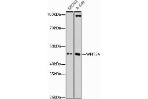 Western blot analysis of extracts of various cell lines, using WNT5A antibody (ABIN3023002, ABIN3023003, ABIN3023004 and ABIN6219340) at 1:1000 dilution. (WNT5A Antikörper  (AA 101-380))
