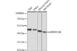 Western blot analysis of extracts of various cell lines, using ZDHHC18 Rabbit pAb (ABIN7271549) at 1:1000 dilution. (ZDHHC18 Antikörper  (AA 301-388))