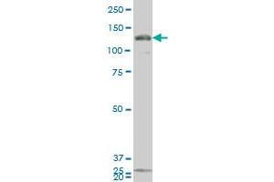 GUCY2C monoclonal antibody (M02), clone 1B11 Western Blot analysis of GUCY2C expression in 293 . (GUCY2C Antikörper  (AA 24-133))