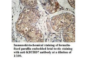 Image no. 1 for anti-Kelch Repeat and BTB (POZ) Domain Containing 7 (KBTBD7) antibody (ABIN1577435) (KBTBD7 Antikörper)