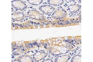 Immunohistochemistry analysis of paraffin-embedded rat colon using,OAS3 (ABIN7072846) at dilution of 1: 4000 (OAS3 Antikörper)
