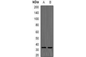 Western blot analysis of TPMT expression in K562 (A), mouse liver (B) whole cell lysates. (TPMT Antikörper)