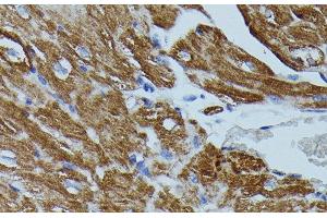 Immunohistochemistry of paraffin-embedded Mouse heart using FKBP1B Polyclonal Antibody at dilution of 1:100 (40x lens).
