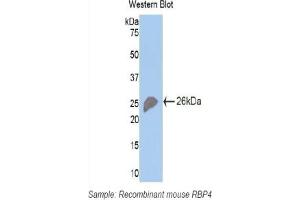 Detection of Recombinant RBP4, Mouse using Polyclonal Antibody to Retinol Binding Protein 4 (RBP4) (RBP4 Antikörper  (AA 63-245))