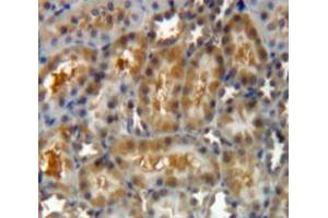 IHC-P analysis of Kidney tissue, with DAB staining. (LGALS8 Antikörper  (AA 151-316))