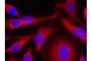 Immunofluorescence staining of methanol-fixed Hela cells using PKD/PKCm(Phospho-Ser738) Antibody. (PKC mu Antikörper  (pSer738))