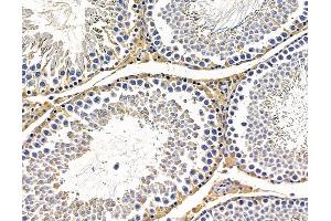 ABIN7096440 and ABIN7100504 at 1/100 staining rat testis tissue by IHC-P. (SPG7 Antikörper)