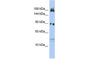 Human OVCAR3; WB Suggested Anti-AFF2 Antibody Titration: 0. (AFF2 Antikörper  (N-Term))