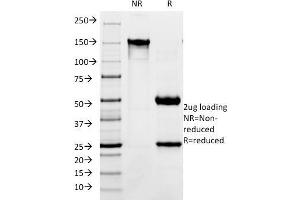SDS-PAGE Analysis Purified CD171 Mouse Monoclonal Antibody (SPM275).