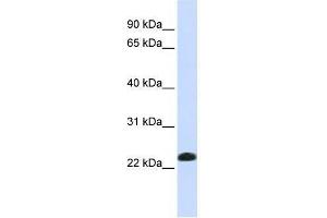 Western Blot showing CAV2 antibody used at a concentration of 1-2 ug/ml to detect its target protein. (Caveolin 2 Antikörper  (N-Term))