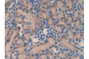DAB staining on IHC-P; Samples: Rat Kidney Tissue (MMP23A Antikörper  (AA 71-383))