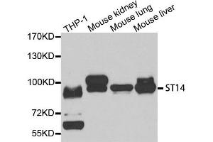 Western Blotting (WB) image for anti-Suppression of Tumorigenicity 14 (Colon Carcinoma) (ST14) antibody (ABIN1877121) (ST14 Antikörper)