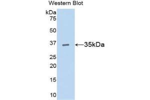 Detection of Recombinant CCND1, Rat using Polyclonal Antibody to Cyclin D1 (CCND1)