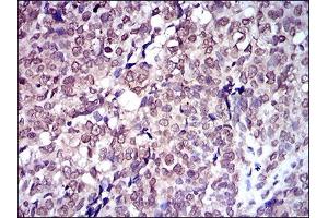 Immunohistochemistry (IHC) image for anti-Solute Carrier Family 2 (Facilitated Glucose Transporter), Member 4 (SLC2A4) (AA 224-353) antibody (ABIN1724743)