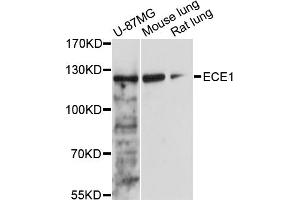 Western blot analysis of extracts of various cell lines, using ECE1 antibody (ABIN5973286) at 1/1000 dilution. (ECE1 Antikörper)