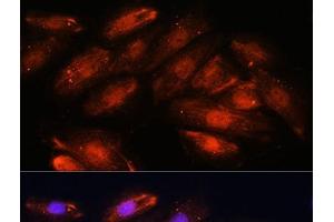 Immunofluorescence analysis of H9C2 cells using OTUB1 Polyclonal Antibody at dilution of 1:100. (OTUB1 Antikörper)